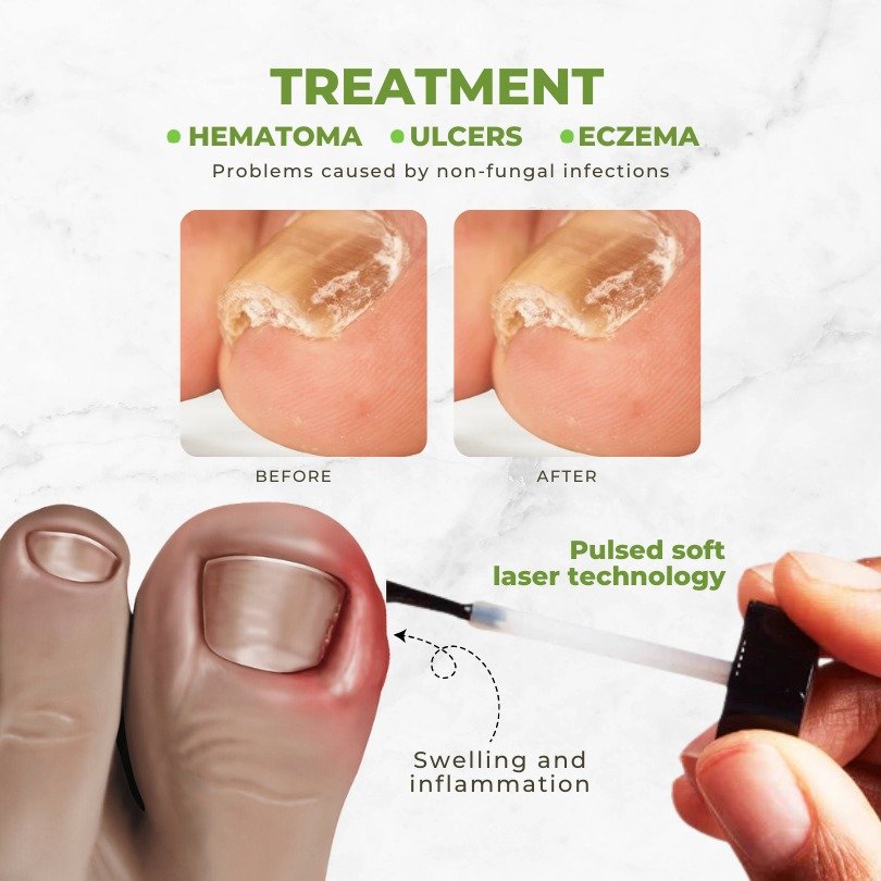 Nail Treatment Oil Bee Venom - 4