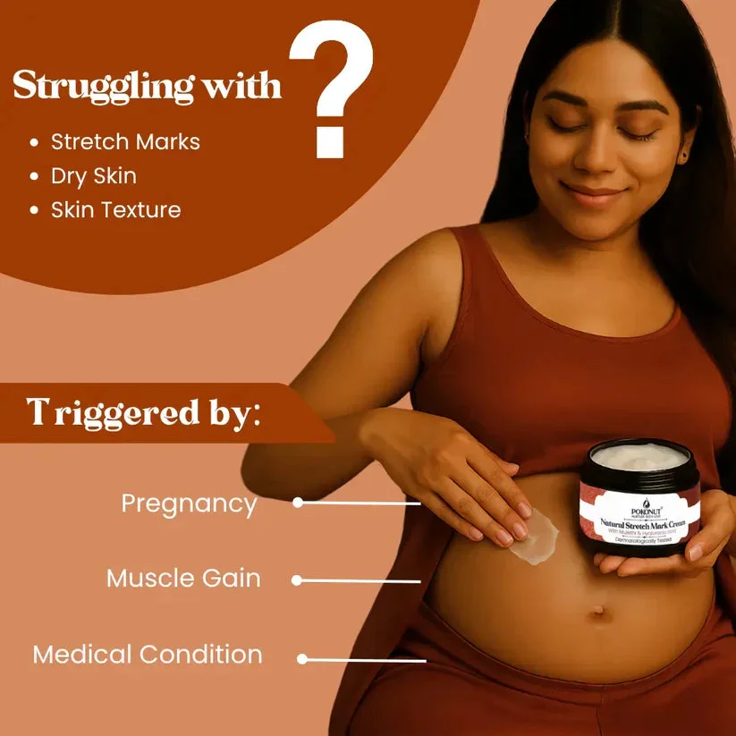 Pregnancy & Weight Stretch Mark Cream - 2
